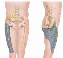 La m&eacute;ralgie paresth&eacute;sique