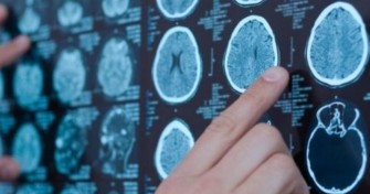 Le craniopharyngiome