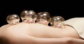 Le Cupping th&eacute;rapie