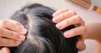 Que faire contre la chute de cheveux saisonni&egrave;re ?