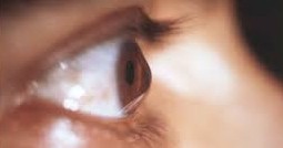 K&eacute;ratoc&ocirc;ne