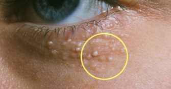 Les grains de milium