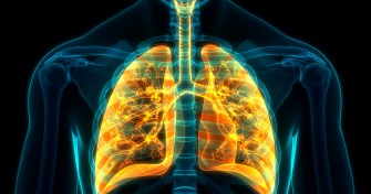 LEmphys&egrave;me pulmonaire