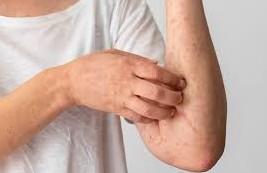 Que faire en cas de r&eacute;actions anaphylactiques ?