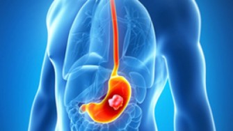 Nouveaut&eacute;s en canc&eacute;rologie digestive ASCO 2006