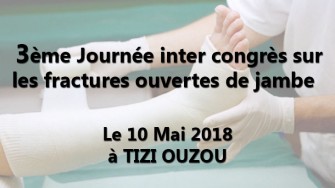 3&egrave;me Journ&eacute;e inter congr&egrave;s sur les fractures ouvertes de jambe - 10 Mai 2018 &agrave; TIZI OUZOU