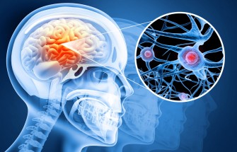  commotion c&eacute;r&eacute;brale