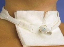 Canule de trach&eacute;otomie