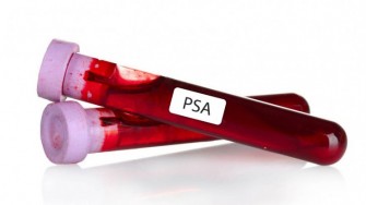 PSA 20 ans apr&eacute;s