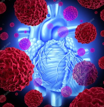 Tumeurs cardiaques canc&eacute;reuses