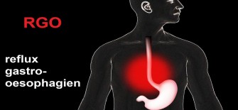 Le reflux gastro-&oelig;sophagien (RGO)