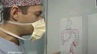 Chirurgie de la Recto-Colite H&eacute;morragique : qui fait le plus fait le mieux