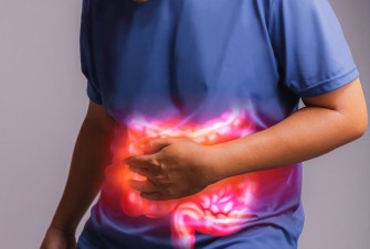 La colopathie fonctionnelle/ c&ocirc;lon irritable