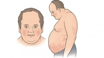 Une nouvelle mol&eacute;cule dans le traitement de la maladie de Cushing