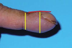 L&rsquo;hippocratisme digital