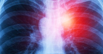 Le m&eacute;soth&eacute;liome