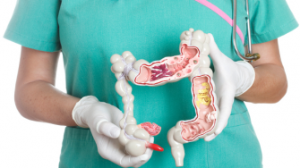 Pr&eacute;vention du cancer du colon 