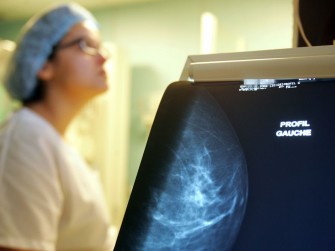 Plan national anti-cancer: d&eacute;finition des zones pilotes pour le d&eacute;pistage du cancer du sein