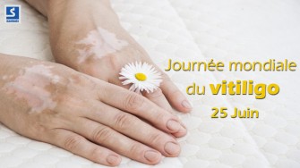 25 Juin : Journ&eacute;e mondiale du vitiligo