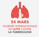 24 Mars : Journ&eacute;e mondiale de lutte contre la tuberculose 